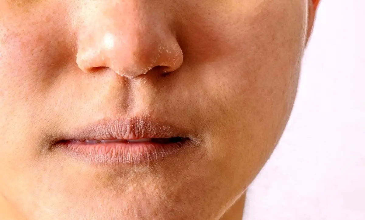 dry-skin-routine-05