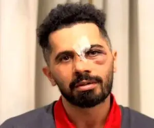 کاپیتان عالیشاه با دندان و بینی شکسته پیام داد