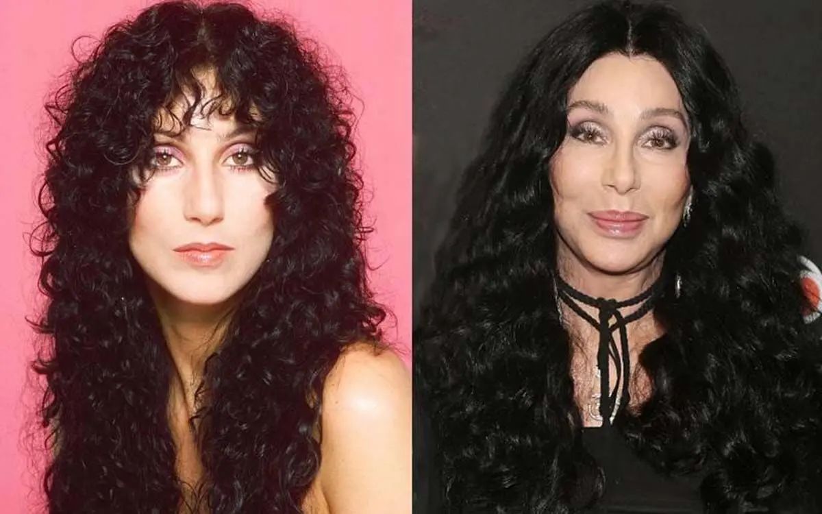 cher-plastic-surgery-30779