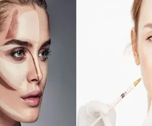هی سیب زمینی میخوری صورتت چاق نمیشه زده به سرت ژل بزنی / قبلش این راهو هم امتحان کن