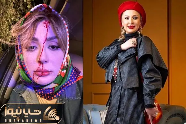 newsha zeighami shayanews