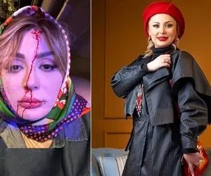 وقتی پروتزای "نیوشا ضیغمی" جلوتر از خودش راه میره؛ شاخ بازیاش به هرچی خفن گفته زِکی!