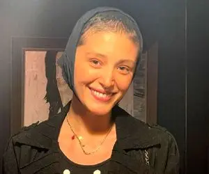 نقش جالب مریم، خواهر فرشته حسینی در ارتودنسی