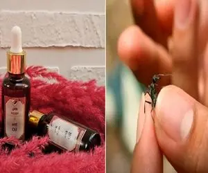 با روغن مورچه موهای زائد واقعا از بین میرن؟ / یه بار برای همیشه جواب این سوال رو بدون