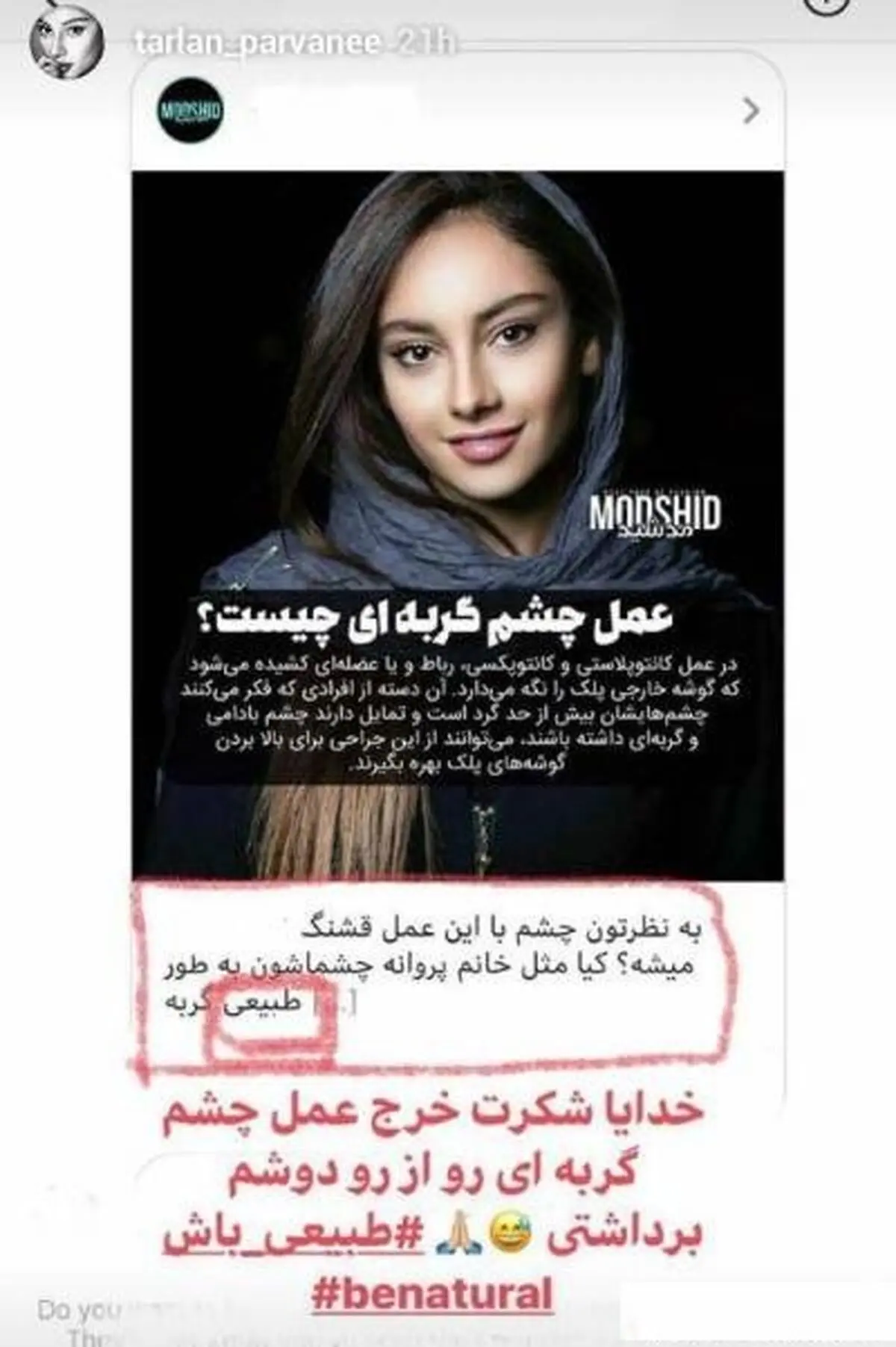 ترلان-پروانه