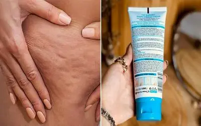 بهترین کرم ها برای از بین بردن سلولیت و ترک پوستی / یه پوست بساز صاف و شیشه ای حظ کنی