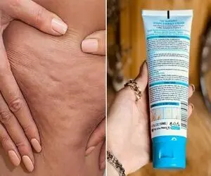 بهترین کرم ها برای از بین بردن سلولیت و ترک پوستی / یه پوست بساز صاف و شیشه ای حظ کنی