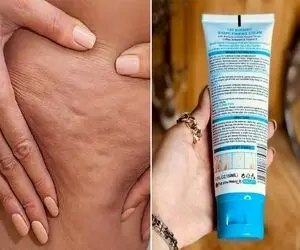 بهترین کرم ها برای از بین بردن سلولیت و ترک پوستی / یه پوست بساز صاف و شیشه ای حظ کنی