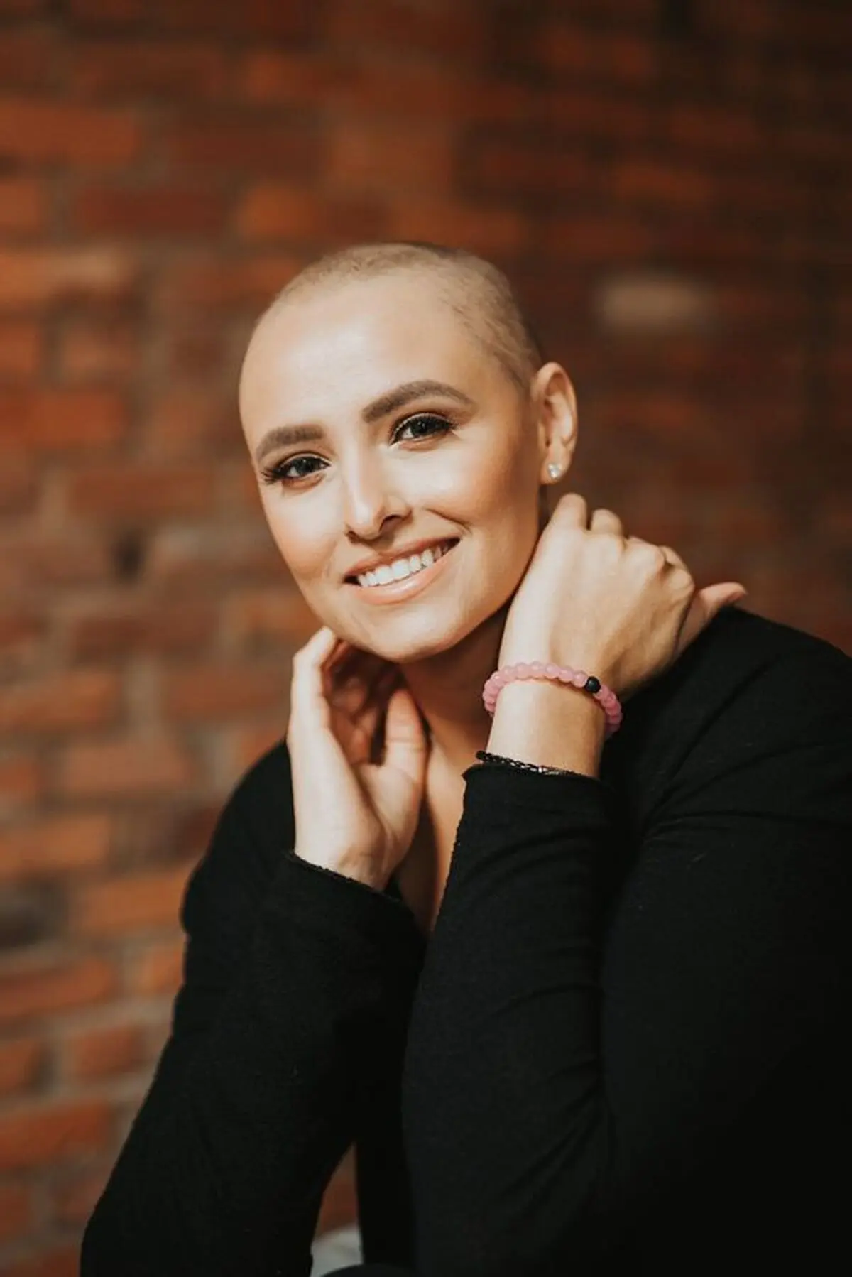 زنان کچل