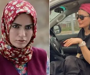 "شیوا طاهری" بازیگر گذر از رنج ها رو یادته؟ ژیگول جان گونه رو قاچید جاش توپ کاشت!