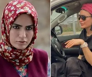 "شیوا طاهری" بازیگر گذر از رنج ها رو یادته؟ ژیگول جان گونه رو قاچید جاش توپ کاشت!