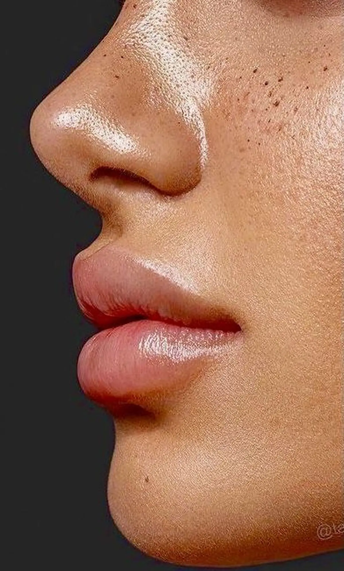 پروتز لب به روش خانگی