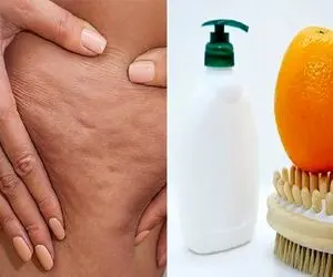 درمان سلولیت با روش های خانگی/ با استفاده این مدلی سرکه تو یه هفته نتیجه اش رو ببین