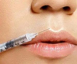 تزریق ژل لب به لب چیست و چگونه انجام می شود ؟