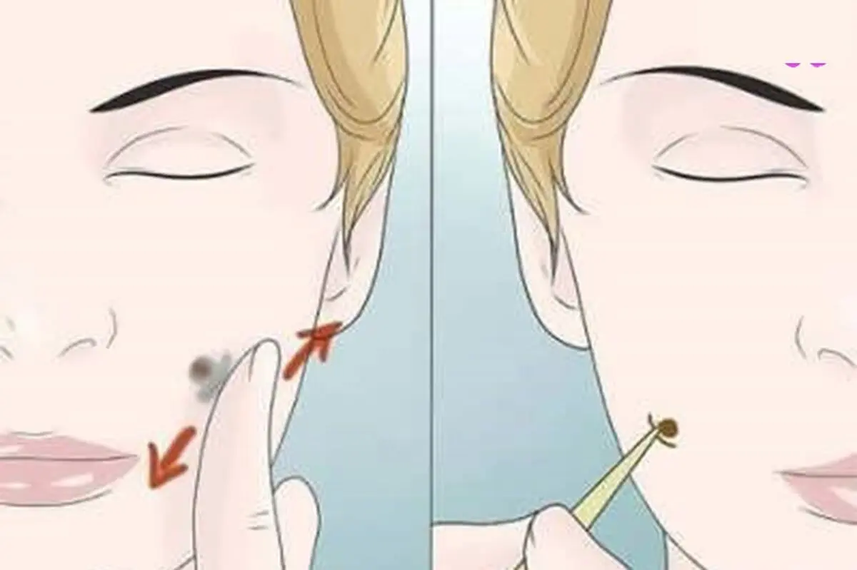 چال گونه