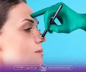 عمل بینی برای چه کسانی خطرناک است؟
