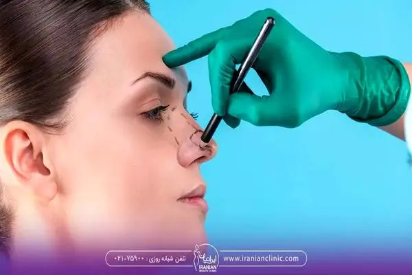 چه افرادی نباید عمل بینی انجام دهند ؟ 