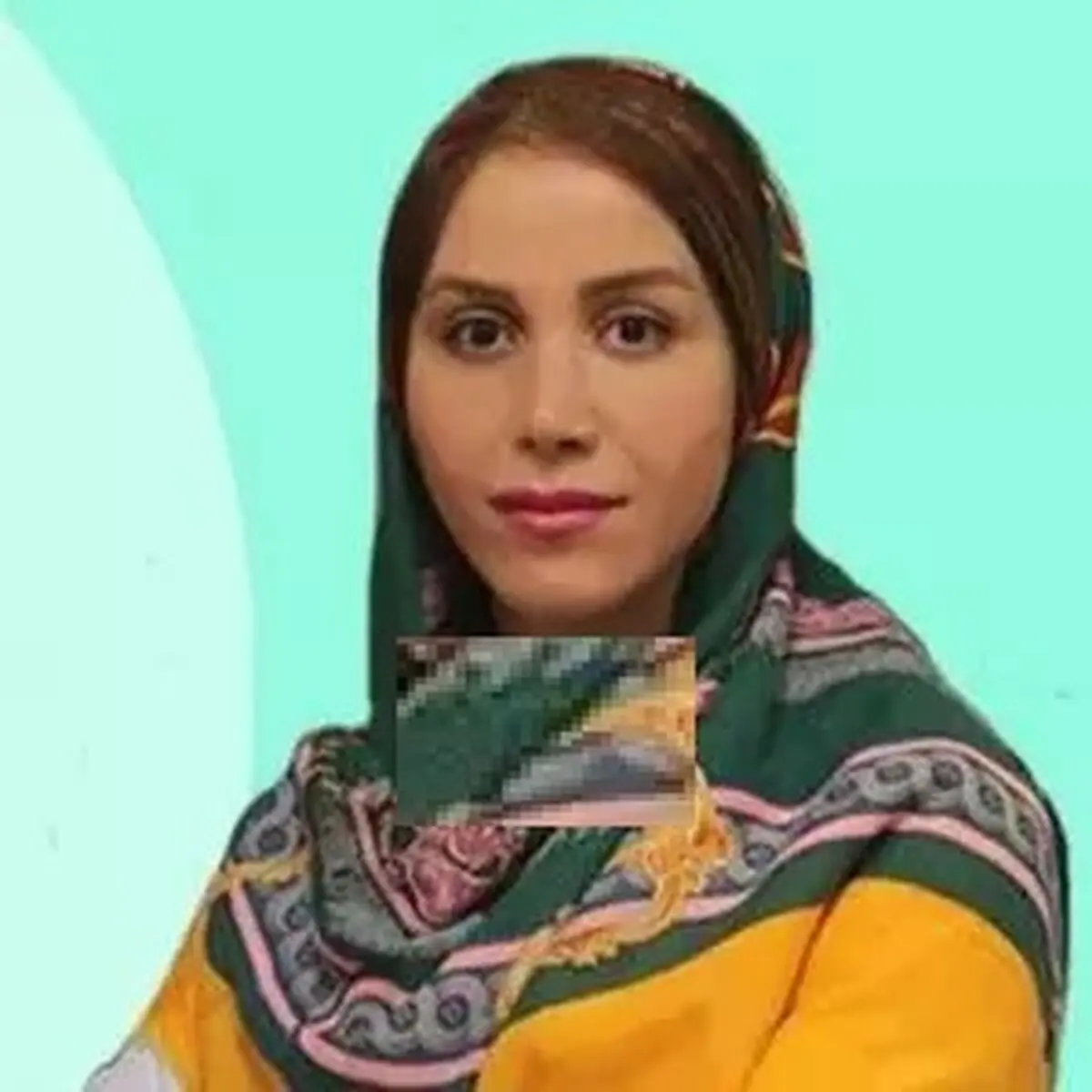 دکتران متخصص در درمان ریزش موی ارثی