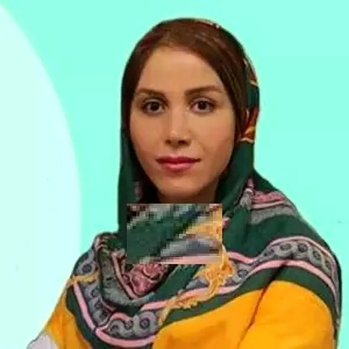 دکتران متخصص در درمان ریزش موی ارثی