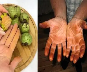 از بین بردن رنگ پوست گردو از دست/ تو فقط فک کن قرار داشته باشی با دست سیاه بری واویلا