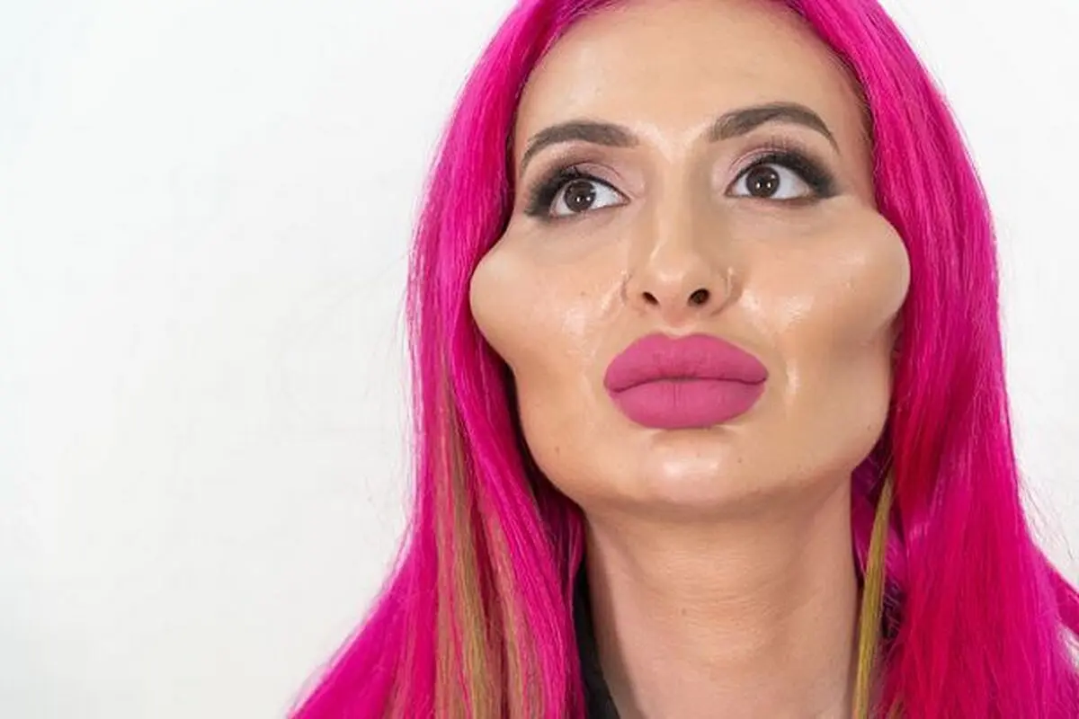 1_I-Have-The-Worlds-Biggest-Cheeks