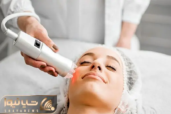 لیزر موهای زائد صورت