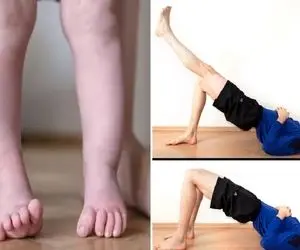 حرکات اصلاحی رفع پا پرانتزی/ تو خونه و رایگان اینکار رو کن 1ماهه پاهات صاف و کشیده اس