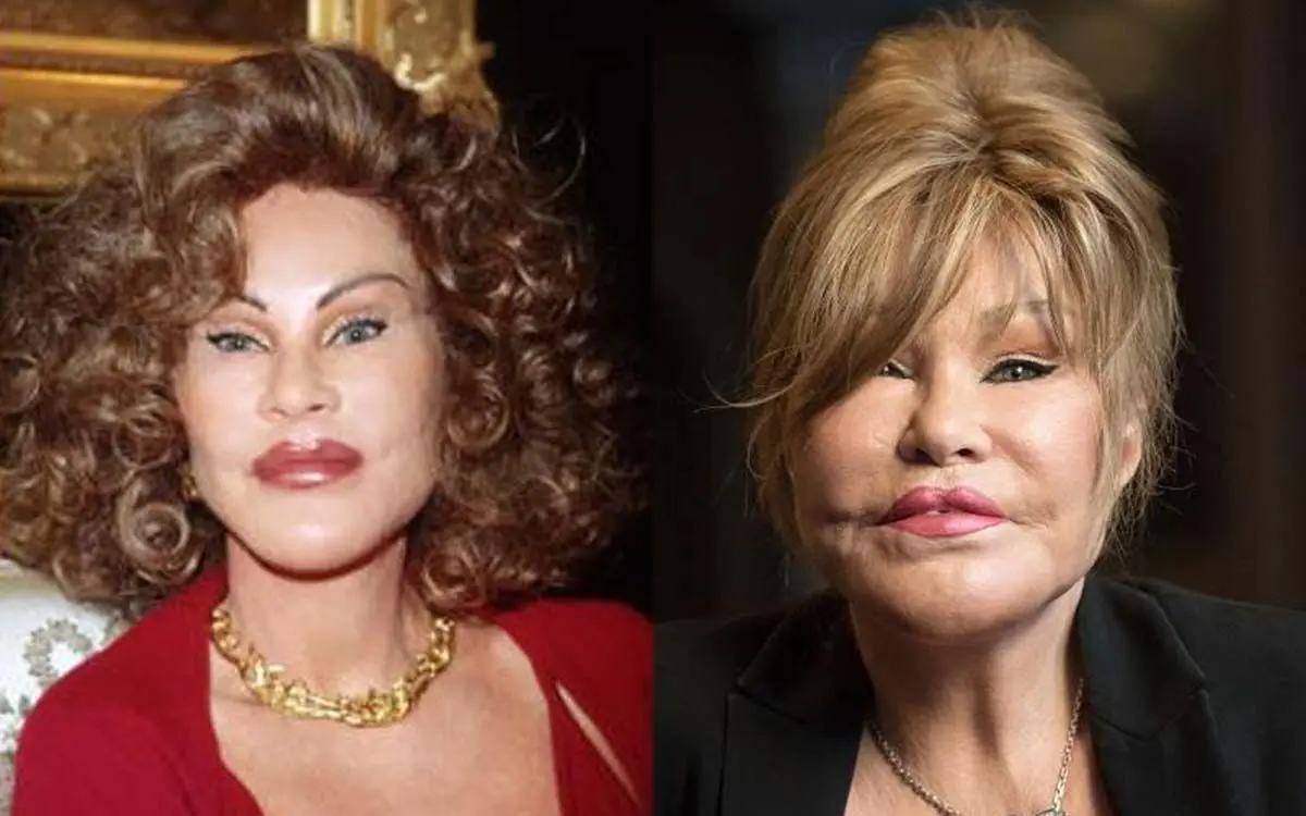 jocelyn-wildenstein-plastic-surgery-93935