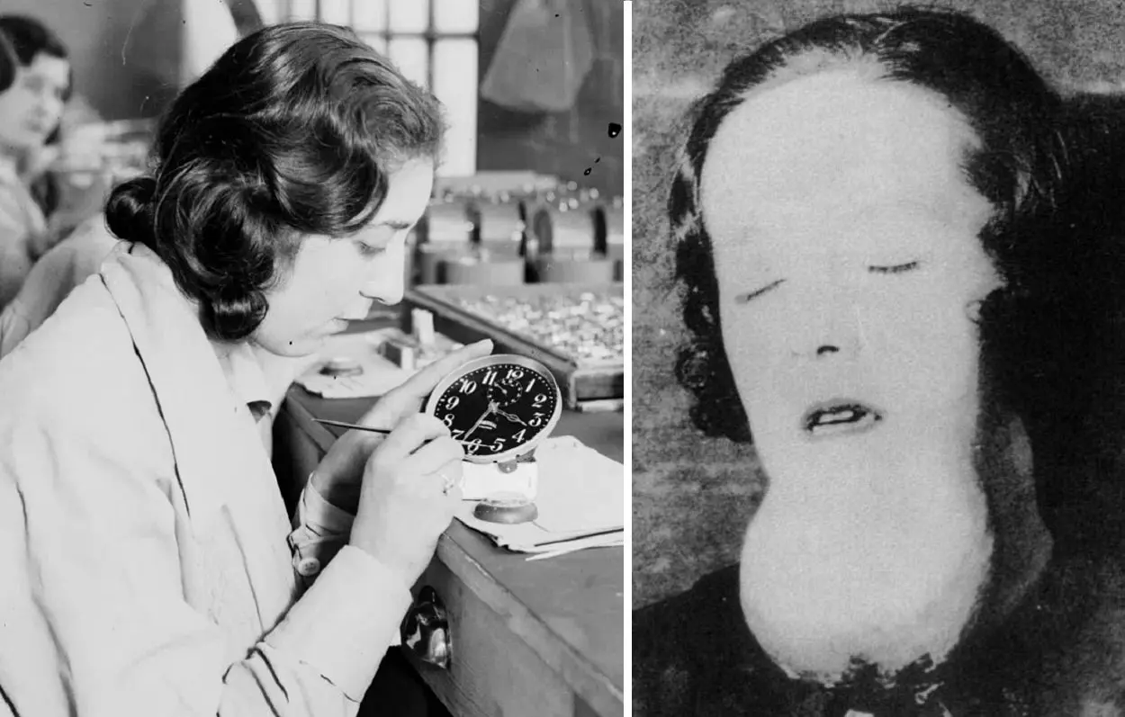 ماجرای غم‌انگیز دختران زحمتکش؛ انقدر در کارخانه با مواد شیمیایی کار کردند تا....