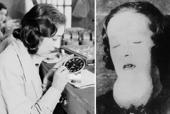 ماجرای غم‌انگیز دختران زحمتکش؛ انقدر در کارخانه با مواد شیمیایی کار کردند تا....