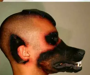 (عکس) باورنکردنی ترین جراحی دنیا، پیوند سر سگ به بدن پسر جوان!