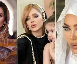 بلاگر های خانومی که با چهرشون حسابی مشهور شدن؛ قبل و بعد عملشون در سوشال مدیا