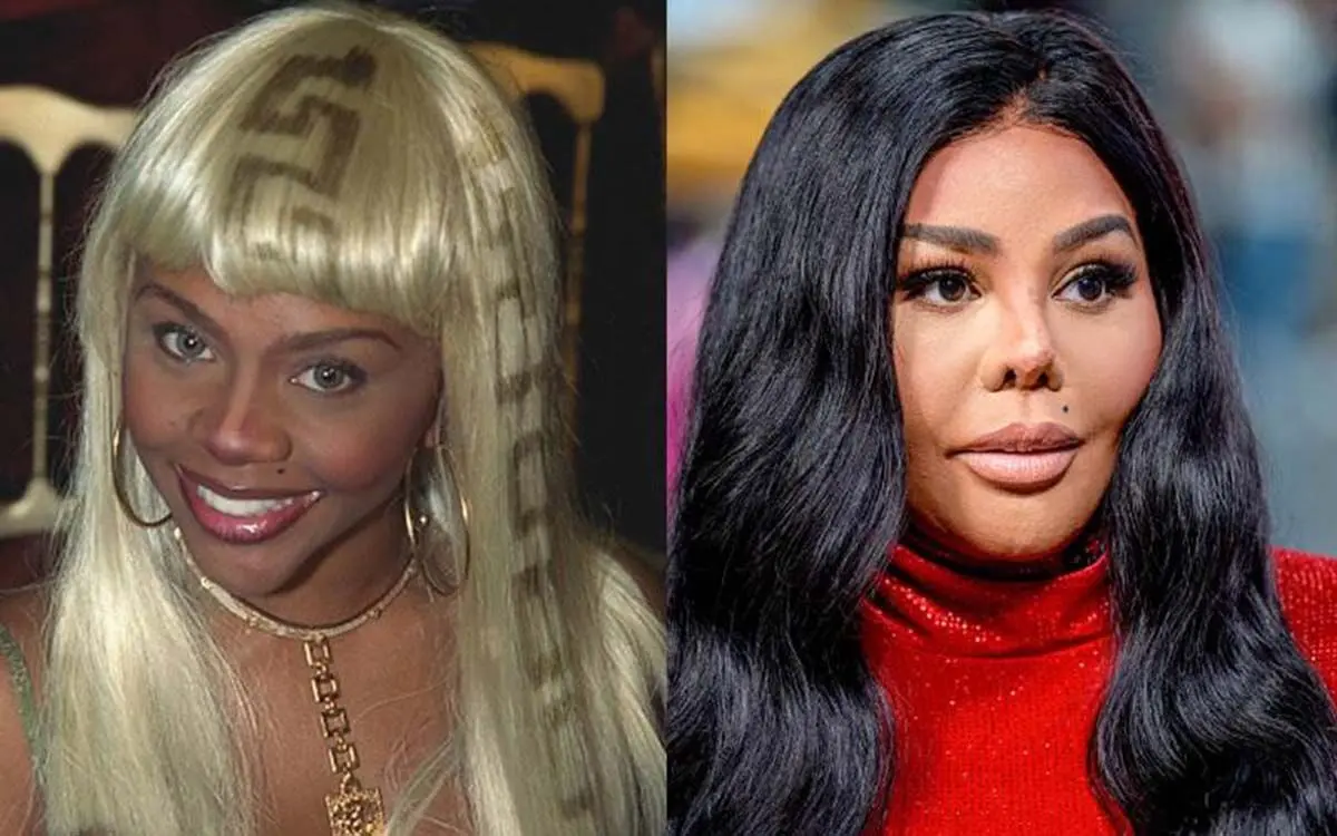 lil-k-before-after-plastic-surgery-80314