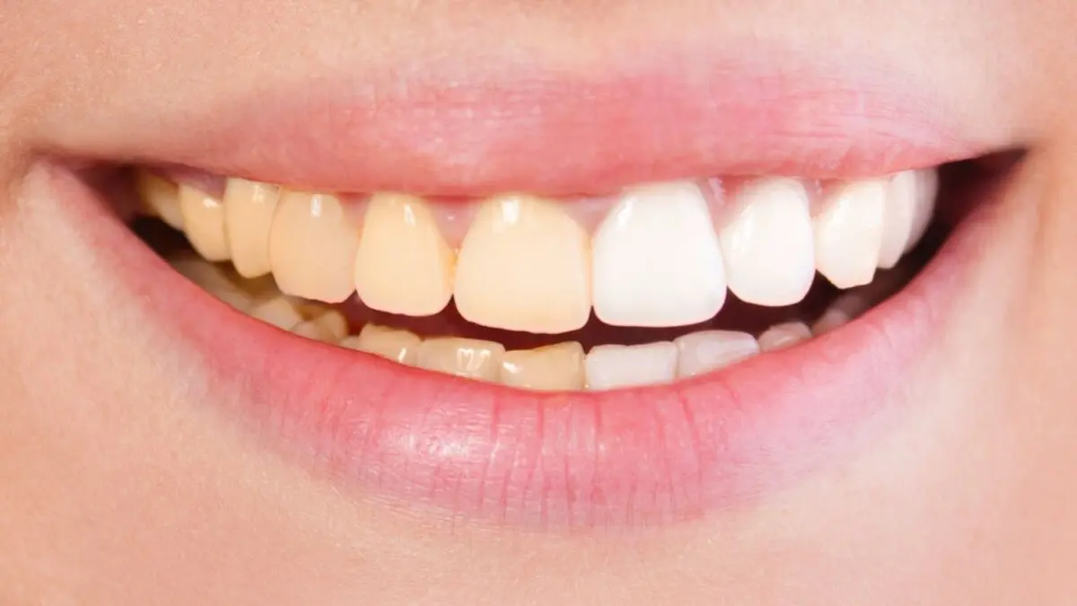iStock_000027430327_Large