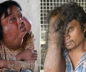 فکر میکنی بدنت همینیه که می بینی؟ یه عالمه رمز و راز داره! حقایقی عجیب از بدن انسان