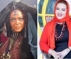 لایو جنجالی بهاره رهنما؛ عمل زیبایی نه فقط بوتاکس!