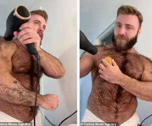 ماجرای مردی که موهای بدنش سه ساعت بعد از اصلاح دوباره پر می شود!