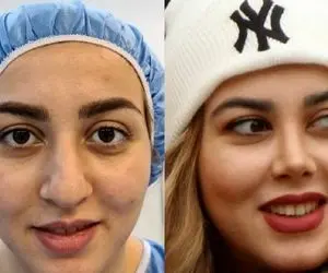 بهترین چالش تغییر در اینستاگرام | از "لولو" تبدیل شد به هلو | ویدیو