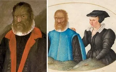 انیمیشن دیو و دلبر دیزنی واقعی است؛ زیباترین دختر فرانسه همسر زشت‌ترین مرد جهان شد!