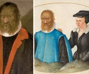 انیمیشن دیو و دلبر دیزنی واقعی است؛ زیباترین دختر فرانسه همسر زشت‌ترین مرد جهان شد!