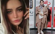 ویدیو جنجالی "سحر قریشی" از عمل زیبایی دختران ایرانی؛ من عمل ندارم! 