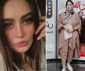 ویدیو جنجالی "سحر قریشی" از عمل زیبایی دختران ایرانی؛ من عمل ندارم! 