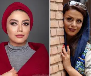 خوشگلاسیون "شبنم فرشادجو" شاخ همه رو درآورد؛ "قشنگ کوبیدی از نو ساختیا"