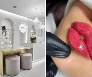 بهترین کلینیک تزریق ژل کرج / چهره ای بدون خط و خش و عفونت با معجزه این پزشکان زبردست