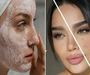 از بین بردن جوش های صورت در کمترین زمان تا عید / با کف دست جوش شیرین پوستتو آینه کن