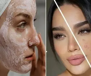 از بین بردن جوش های صورت در کمترین زمان تا عید / با کف دست جوش شیرین پوستتو آینه کن