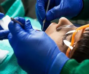 خبر خوب از دندانپزشکی؛ خدمات بیمه ای وسیع تر می شوند؟