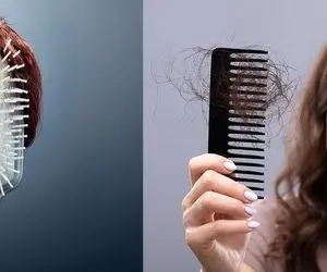 اگه ریزش مو دارید این خورکی ها را به هیچ وجه نخورید!