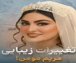 تغییرات زیبایی مریم مومن قبل اینکه عروس شه / خانم کاری نمونده نکرده باشه