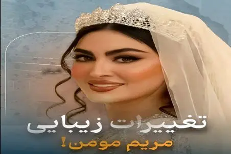 تغییرات زیبایی مریم مومن قبل اینکه عروس شه / خانم کاری نمونده نکرده باشه